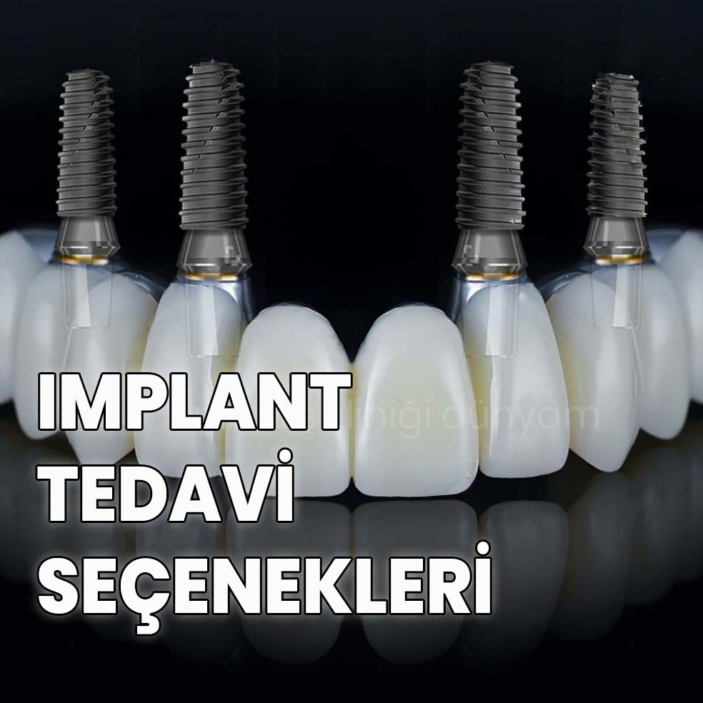İmplant Tedavi Seçenekleri